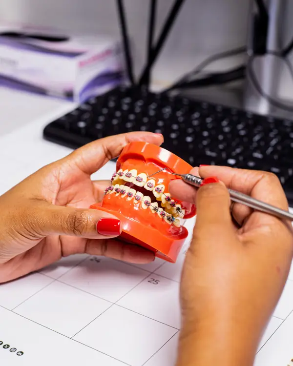 Explaining treatment on a model