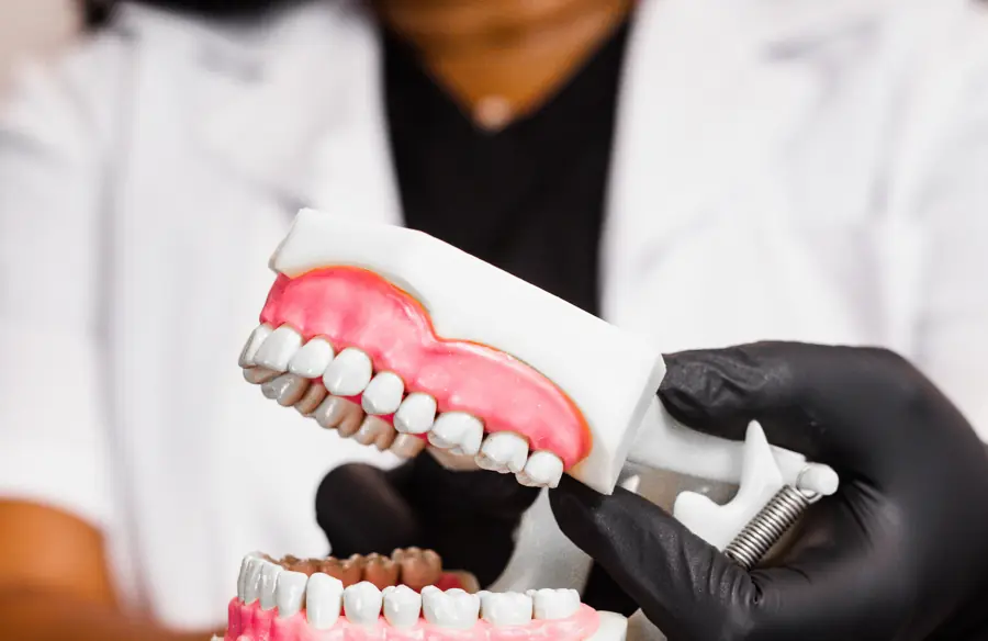 Teeth Whitening
